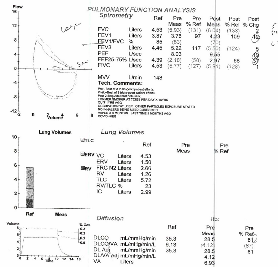 Having trouble interrupting my PFT results